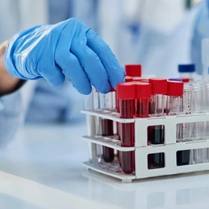 Automated clinical pathology laboratory analyzer machines and blood sample test tubes in modern diagnostic center lab