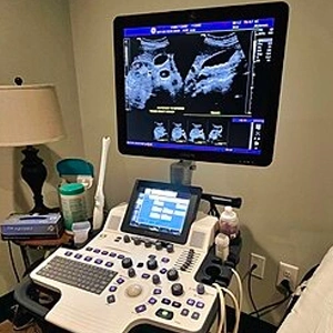 High resolution digital ultrasound sonography diagnostic scanner machine with monitor in clean hospital clinical room
